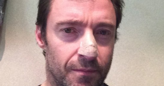 Hugh Jackman