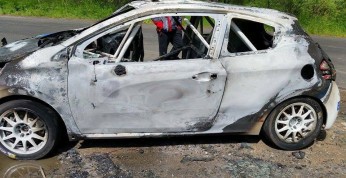 Radosław Typa z poparzeniami po Rajdzie Karkonoskim. 