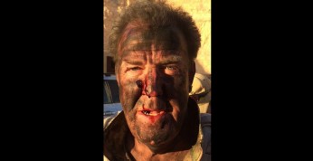 Jeremy Clarkson udostępnił zdjęcie z poranioną twarzą. Co się...